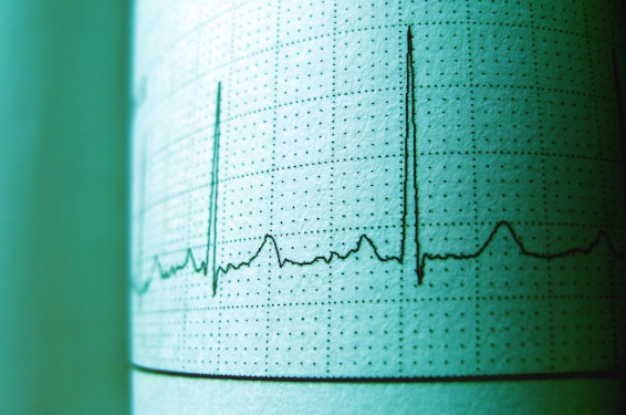 heart rate spikes on graph